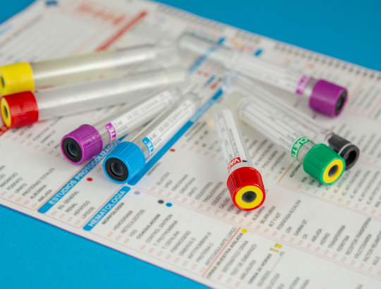 Щелочная фосфатаза: что показывает анализ