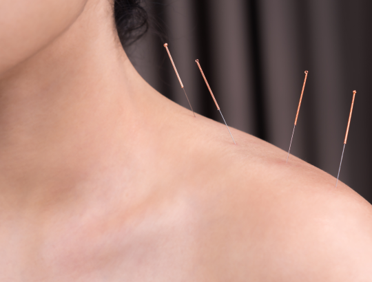 Иглоукалывание под микроскопом доказательной медицины