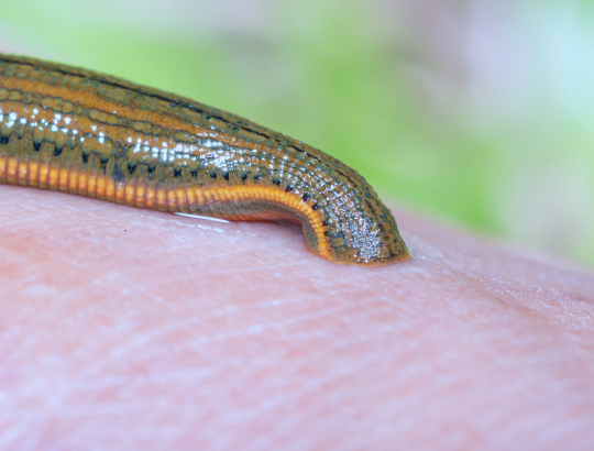 Гирудотерапия в современной медицине: мифы, факты и ограничения