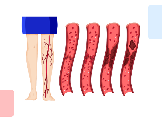 Шкала IMPROVEDD