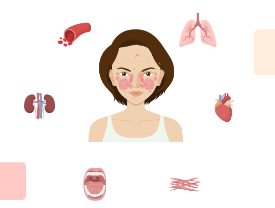 Шкала SLEDAI-2K