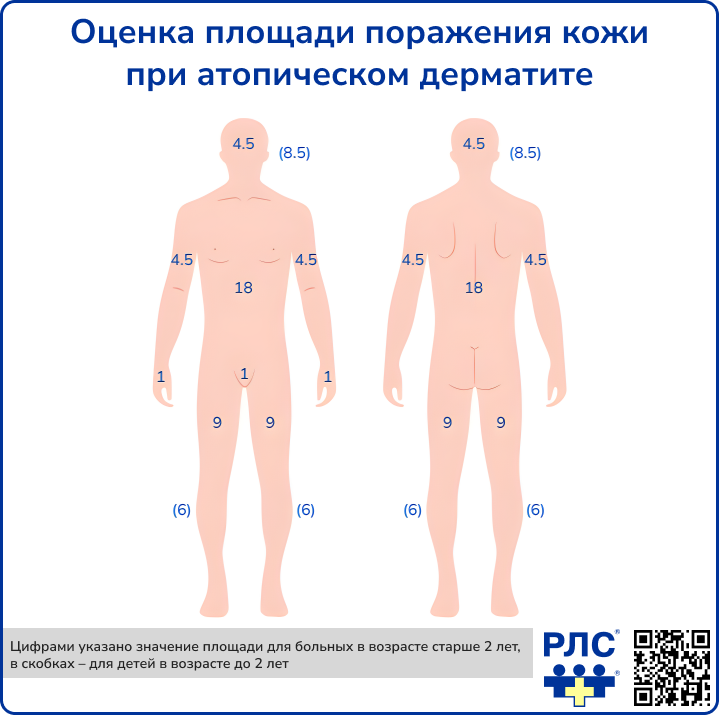 Оценка площади поражения кожи при атопическом дерматите