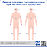 Оценка площади поражения кожи при атопическом дерматите, превью