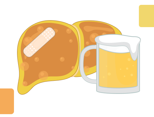 Индекс Лилль