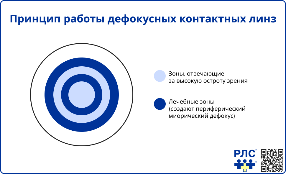 Принцип работы дефокусных контактных линз
