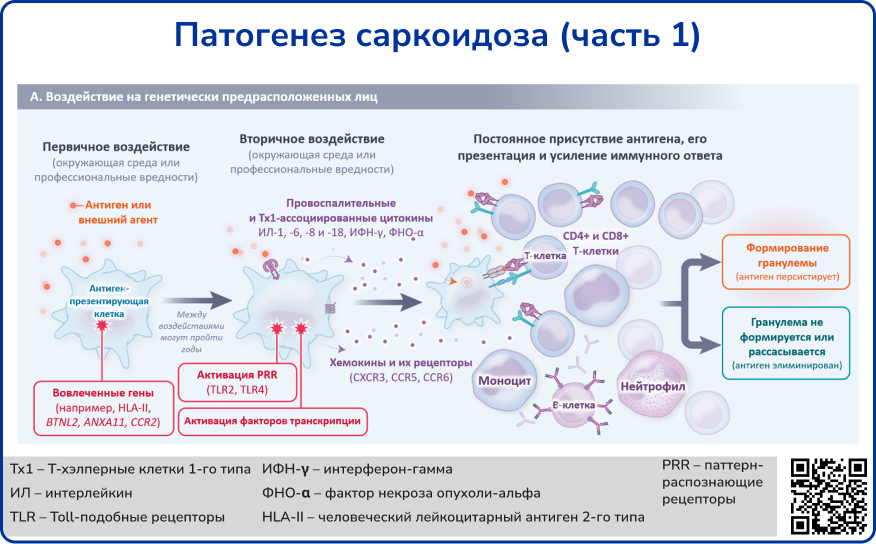 Патогенез саркоидоза 1
