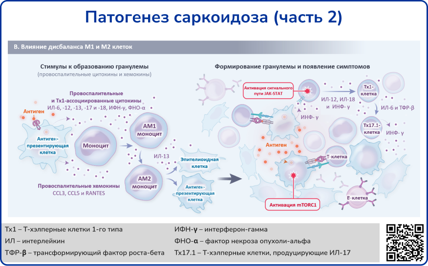 Патогенез саркоидоза 2