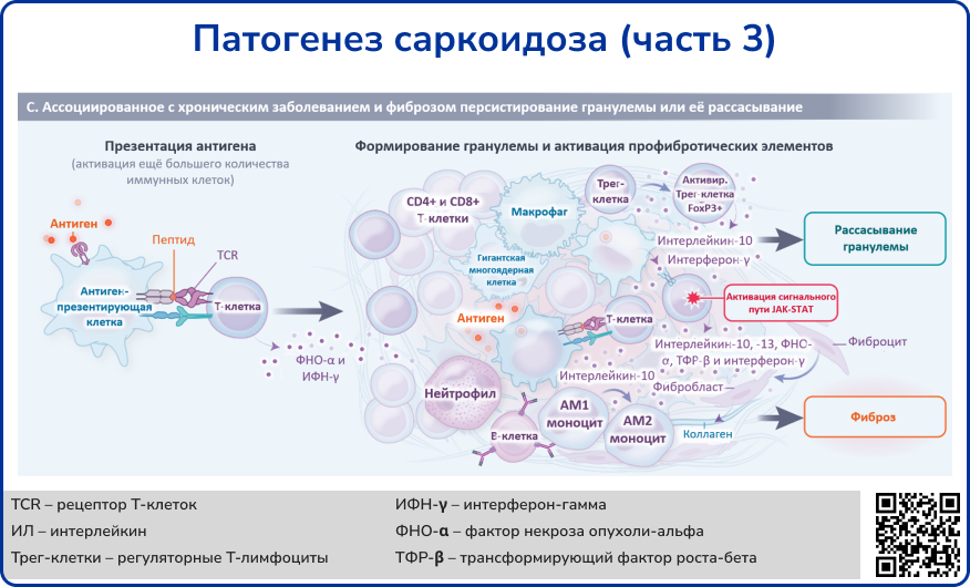 Патогенез саркоидоза 3