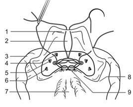Перитонизация малого таза