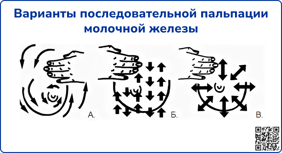 Варианты последовательной пальпации молочной железы