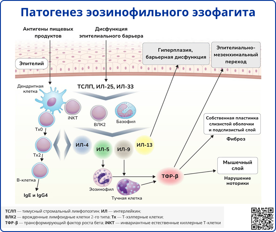 Патогенез эозинофильного эзофагита