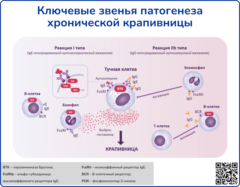 Патогенез крапивницы