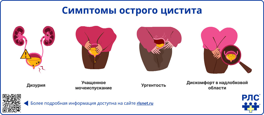Симптомы острого цистита