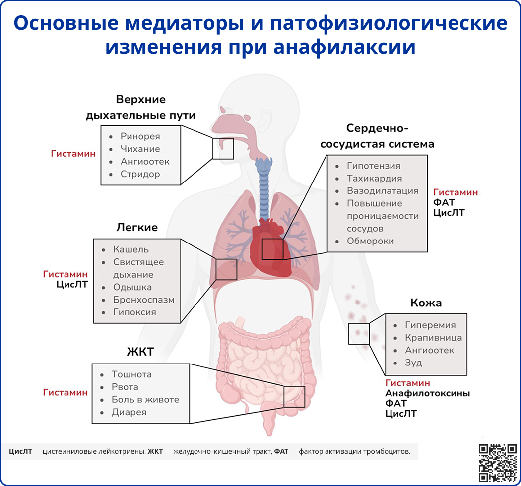 Основные медиаторы и патофизиологические изменения при анафилаксии