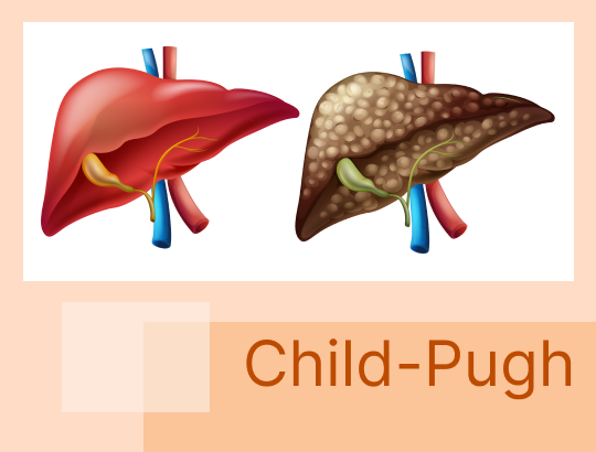 Новый калькулятор «Шкала Child-Pugh»