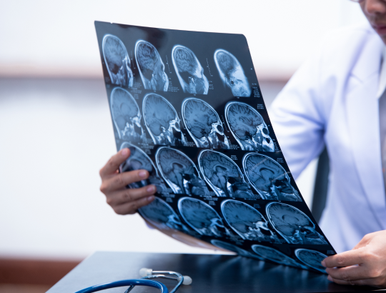 Апиксабан — обновленное описание антикоагулянта