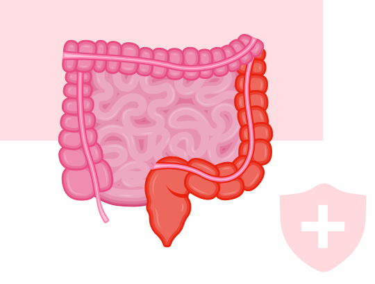Новый калькулятор «Индекс Мейо»
