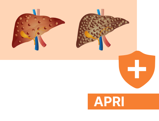 Новый калькулятор «Индекс APRI»