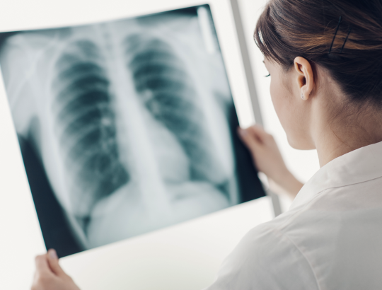 Саркоидоз: новая информация для специалистов