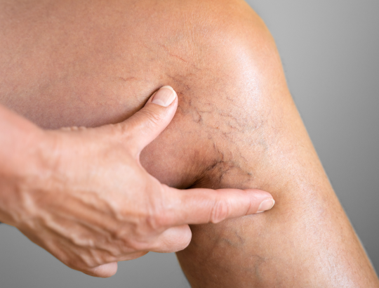 Акушерская тромбоэмболия: новая информация для специалистов