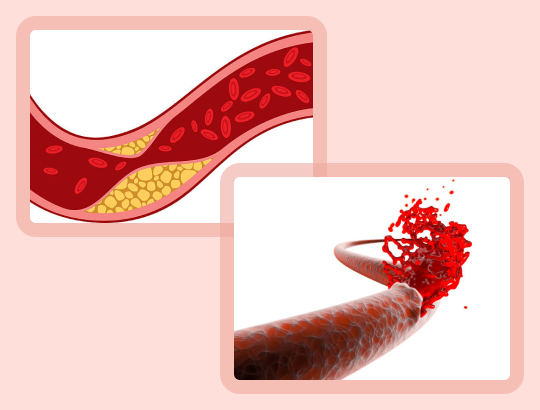 Новый калькулятор: «Шкала REACH»