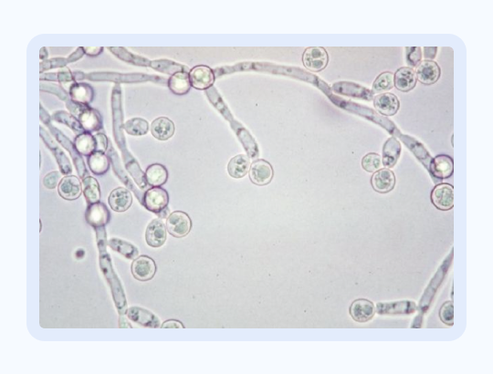 Новый калькулятор: «Candida Score»