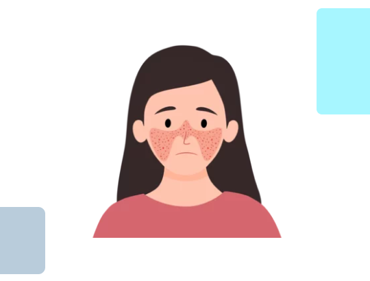 Новый калькулятор: Диагностические критерии системной красной волчанки