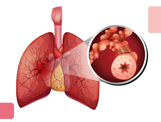 Новый калькулятор: Индекс BODE