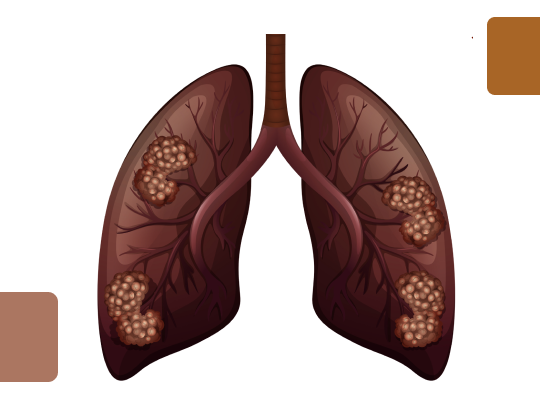 Новый калькулятор: Индекс курения