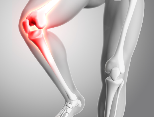 Гонартроз: новая информация для специалистов